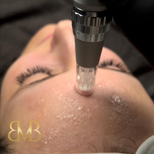 Microneedling Rücken